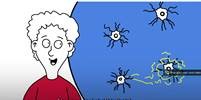 still animatie epilepsie chirurgie