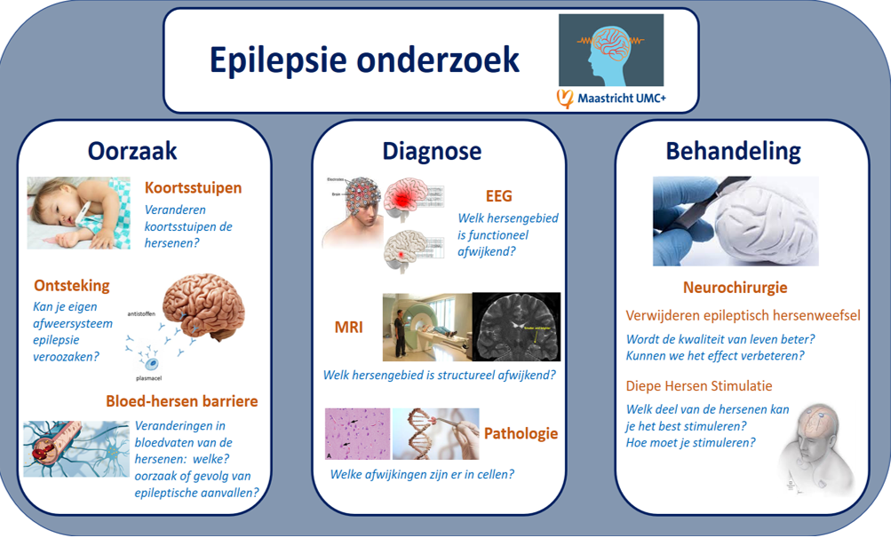 Onderzoek epilepsie