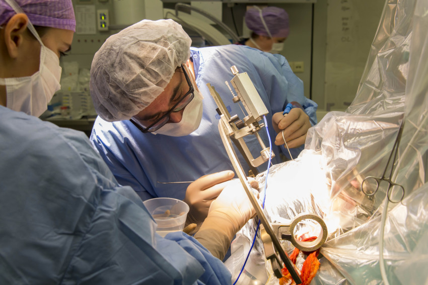 dbs neurochirurgie